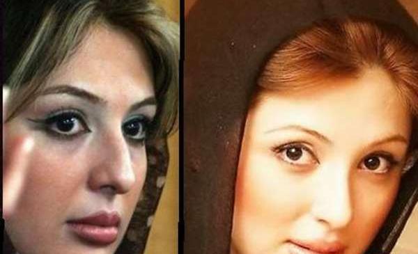 عکس قبل از عمل زلیخا