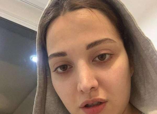 عکس های زشت صورت