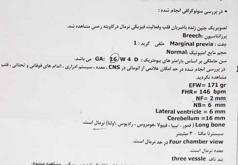 عکس سونوگرافی ضربان قلب پسر